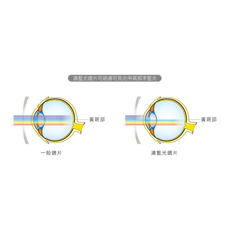 WIDE 配鏡加購 3101