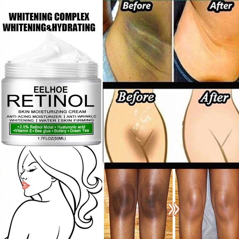 Body Whitening Cream Private Parts Underarm Serum Knee Bright Inner Thigh Dark Intimate Remove Melanin 20ml